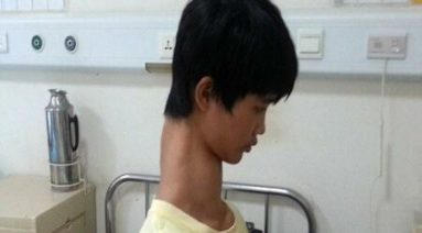 Ce Chinois aurait le plus long cou naturel du monde