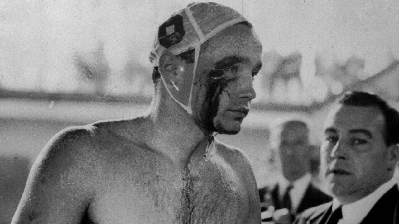 Dans cette photo d'archive du 6 décembre 1956, du sang coule de l'œil coupé du Hongrois Ervin Zador blessé lors d'un combat avec un membre de l'équipe soviétique lors des dernières étapes du match de water-polo Hongrie contre URSS à Melbourne, en Australie.