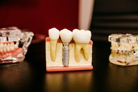 Que faire pour avoir une bonne hygiène bucco-dentaire ?