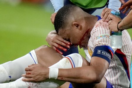 Les dirigeants de l'équipe de France transpirent suite à la blessure au visage de Kylian Mbappé