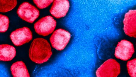La France confirme le premier cas de nouveau virus mpox au milieu de l'alerte mondiale de l'OMS